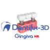 dental prosthesis showing how 3d printable dental resin is used